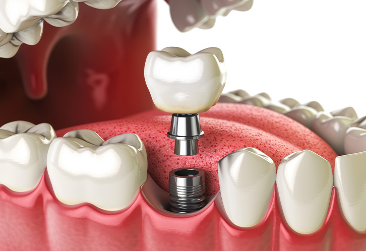 mediDental care | Periodontal Treatment, Oral Exams and Oral Surgery