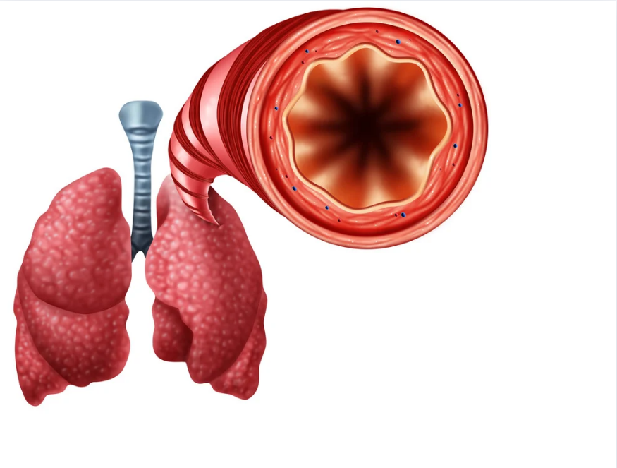 mediDental care | Ceramic Crowns, Dental Bridges and Implant Dentistry