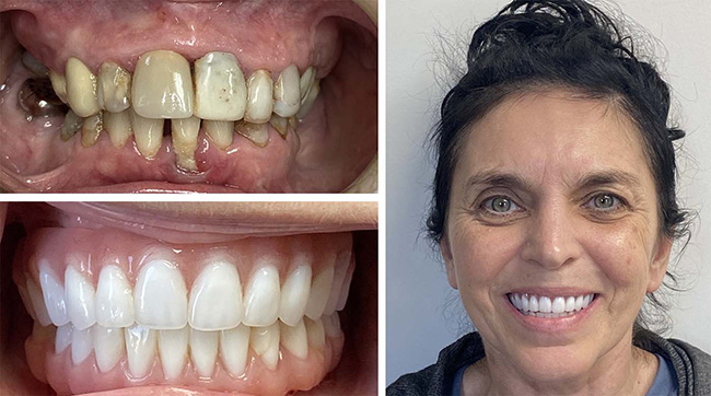 mediDental care | Root Canals, TMJ Disorders and Sedation Dentistry