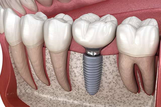 mediDental care | Periodontal Treatment, Oral Exams and Oral Surgery