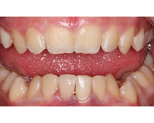 mediDental care | Root Canals, Oral Surgery and Ceramic Crowns