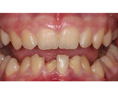 mediDental care | Invisalign&reg;, Extractions and Veneers