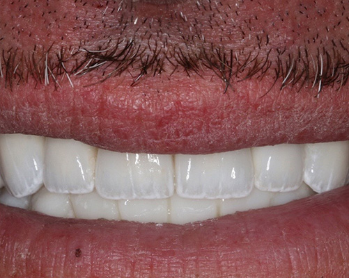 mediDental care | Ceramic Crowns, Oral Surgery and Dental Bridges