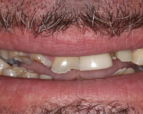 mediDental care | Implant Dentistry, Veneers and TMJ Disorders