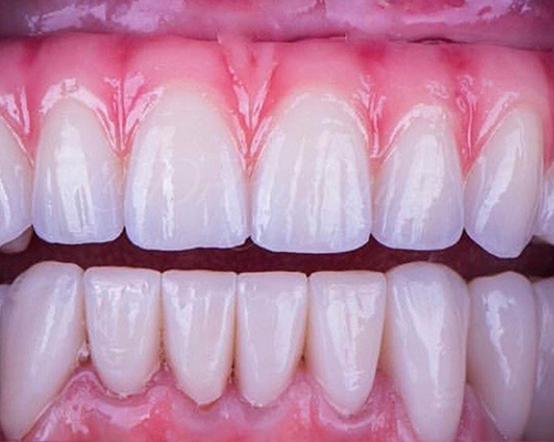 mediDental care | Oral Surgery, Periodontal Treatment and Root Canals