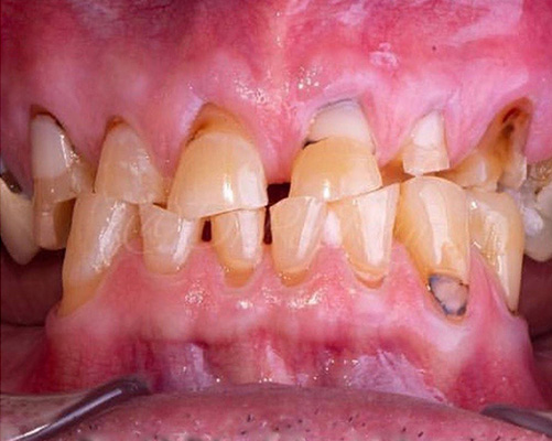 mediDental care | Dentures, Teeth Whitening and Dental Bridges