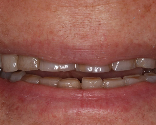 mediDental care | Ceramic Crowns, Emergency Treatment and Cosmetic Dentistry