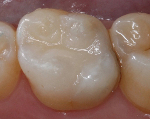 mediDental care | Implant Dentistry, Dentures and Cosmetic Dentistry