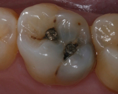 mediDental care | Implant Dentistry, Root Canals and Teeth Whitening