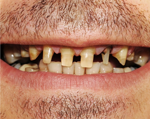 mediDental care | Root Canals, Ceramic Crowns and Sedation Dentistry