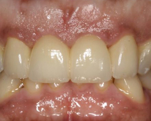 mediDental care | Root Canals, Ceramic Crowns and Implant Dentistry