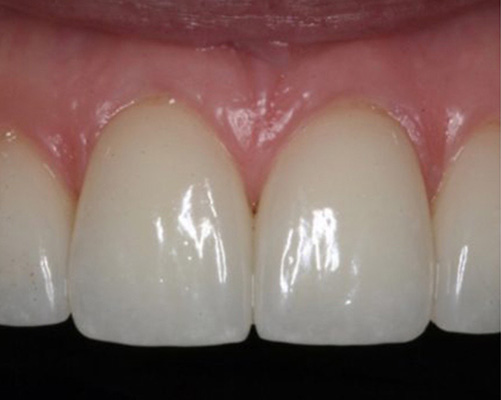 mediDental care | Emergency Treatment, Implant Dentistry and Dentures