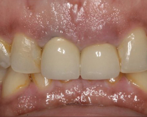 mediDental care | Oral Surgery, Extractions and Dental Fillings