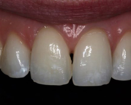 mediDental care | Oral Exams, Ceramic Crowns and Periodontal Treatment