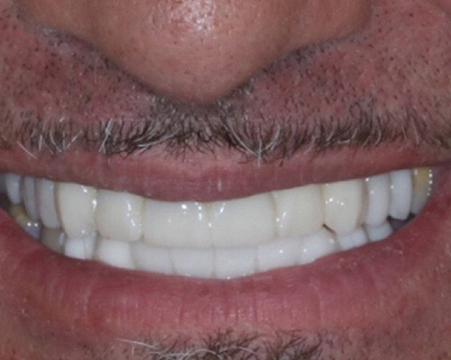 mediDental care | Teeth Whitening, Cosmetic Dentistry and Emergency Treatment