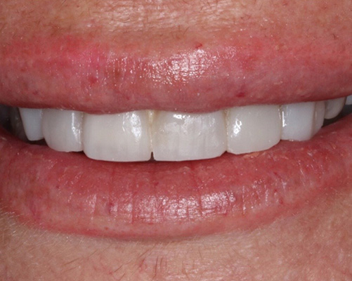 mediDental care | Oral Surgery, Ceramic Crowns and Invisalign&reg;