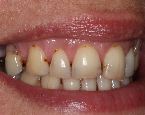 mediDental care | Extractions, Invisalign&reg; and TMJ Disorders