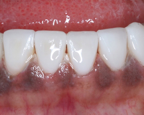 mediDental care | Cosmetic Dentistry, Veneers and Teeth Whitening