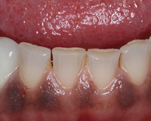 mediDental care | Invisalign&reg;, Dental Bridges and Teeth Whitening