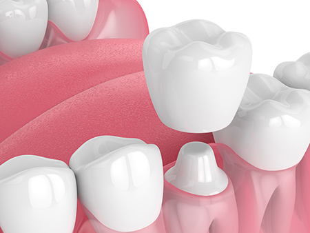 mediDental care | Veneers, Extractions and TMJ Disorders